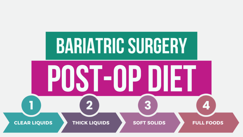 Bariatric Surgery Post-Op Diet Guidelines